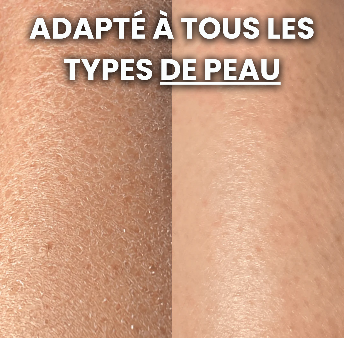 Gant Exfoliant ELIOS - Poils Incarnés & Peaux Mortes - Elios