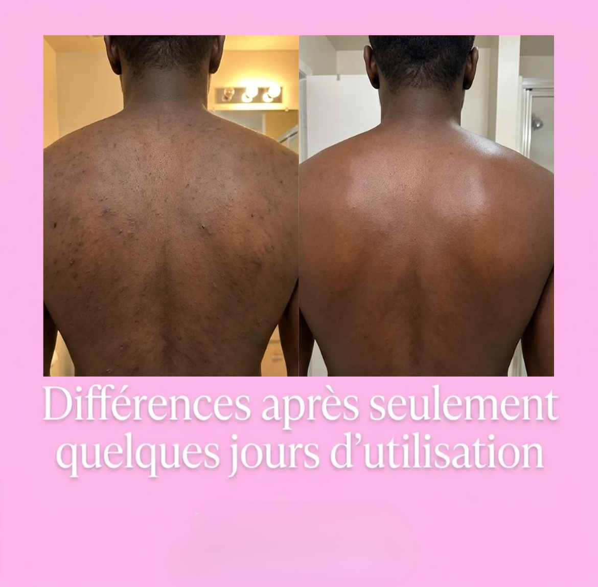 Serviette de douche exfoliante ELIOS - Elios