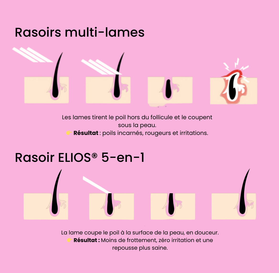 Rasoir ELIOS® + Gant Exfoliant Offert