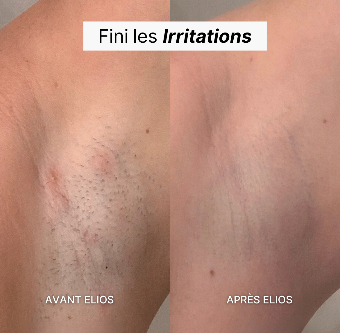 Rasoir ELIOS® + Gant Exfoliant Offert