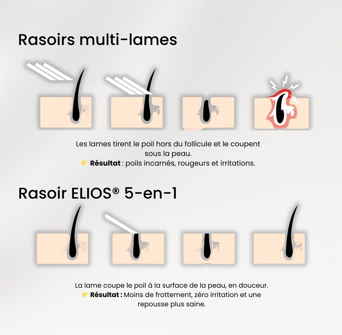 Rasoir ELIOS® + Gant Exfoliant Offert