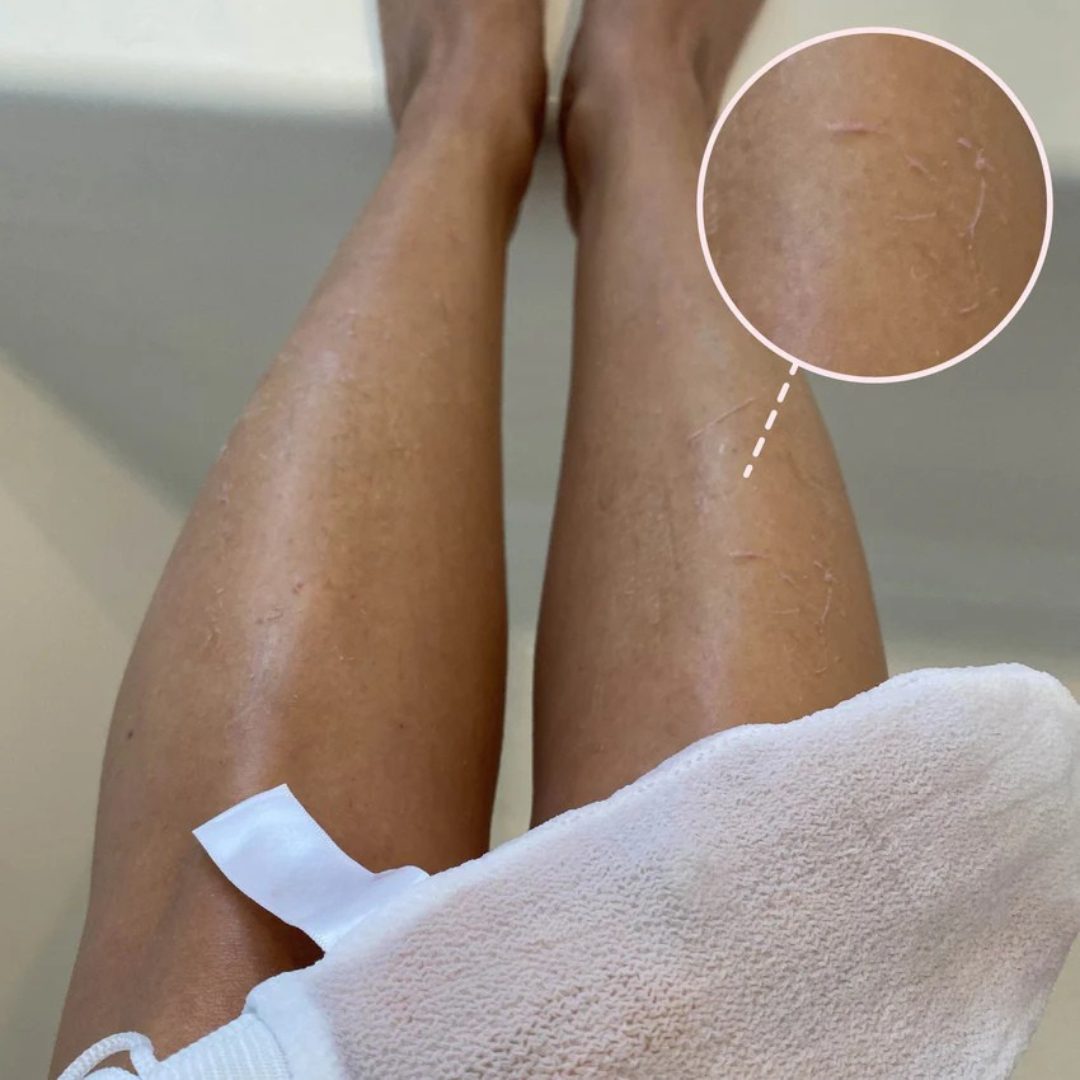 Gant Exfoliant ELIOS - Poils Incarnés & Peaux Mortes - Elios
