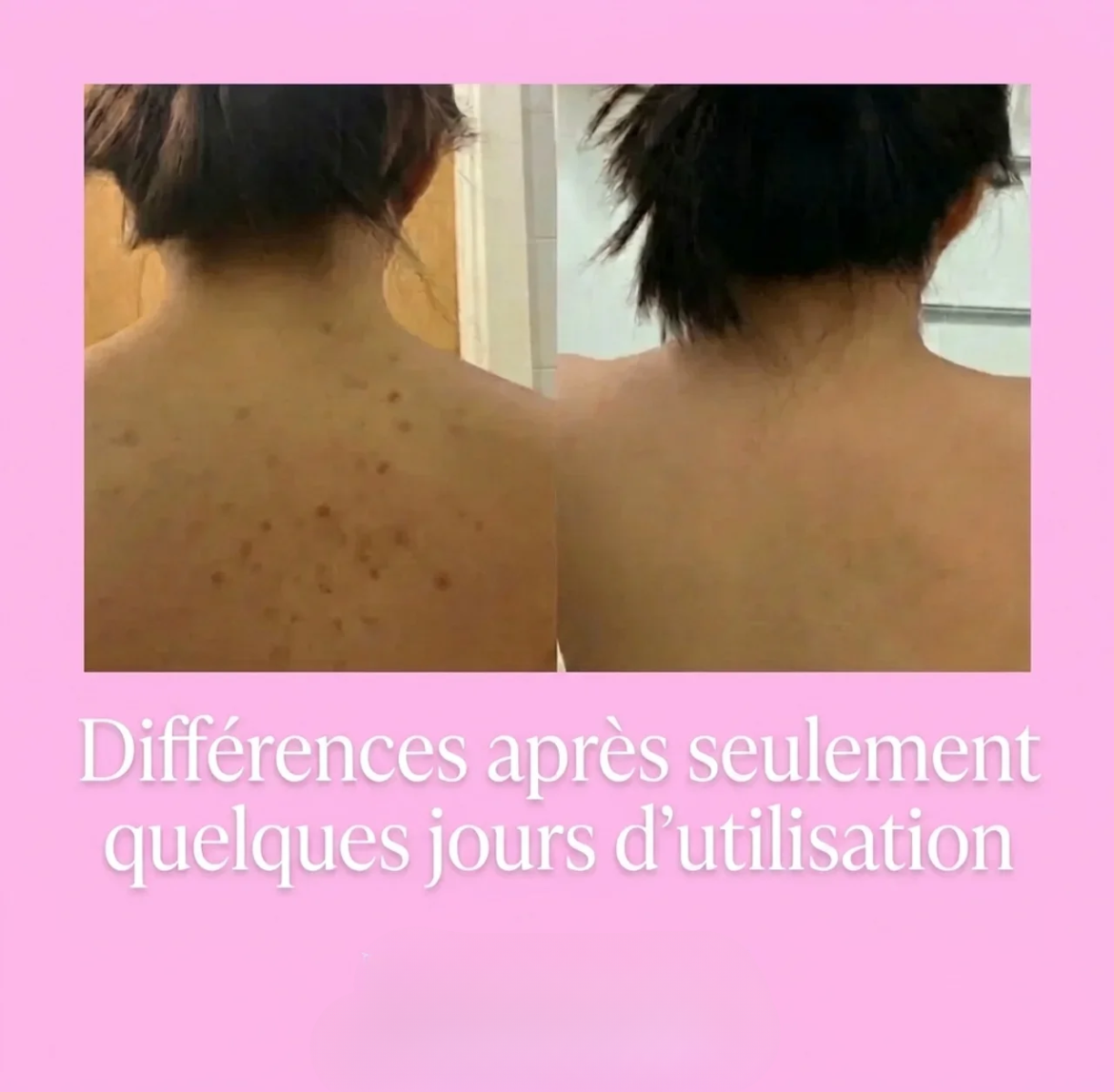 Serviette de douche exfoliante ELIOS - Elios